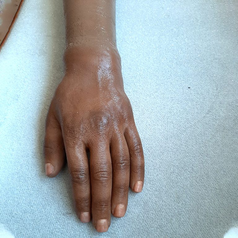 انواع پوست های زیبایی شرکت بهبود عضو ثانی (2)