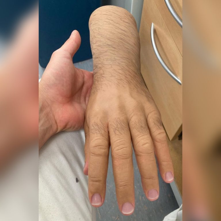 انواع پوست های زیبایی شرکت بهبود عضو ثانی (3)