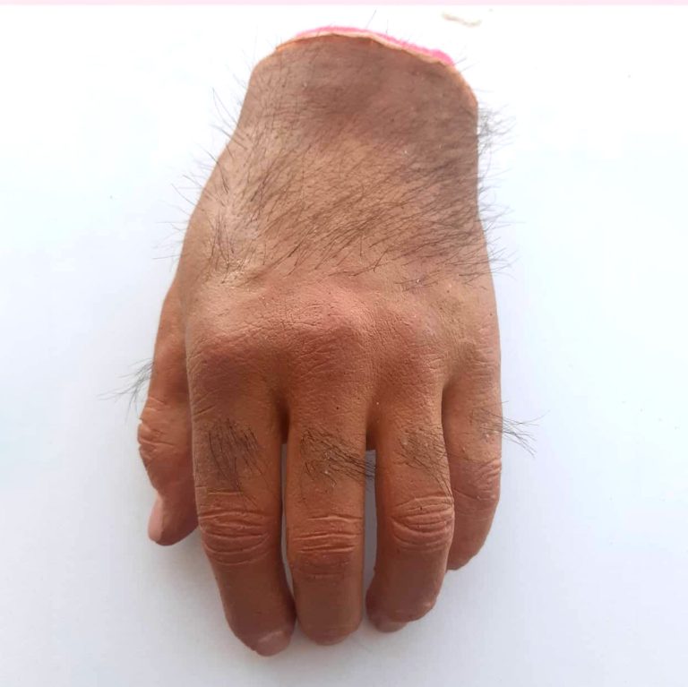 انواع پوست های زیبایی شرکت بهبود عضو ثانی (4)