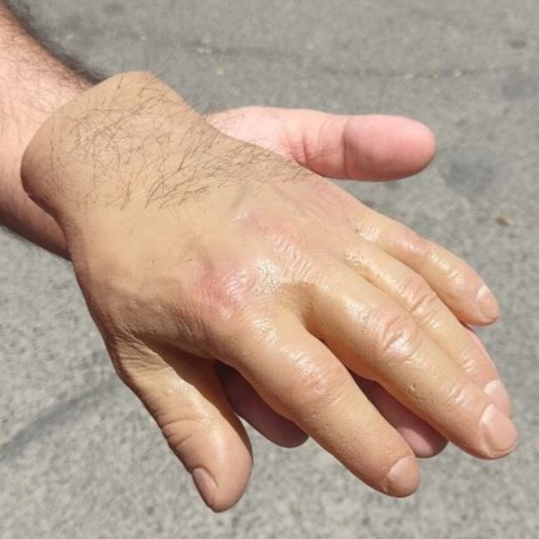 انواع پوست های زیبایی شرکت بهبود عضو ثانی (7)