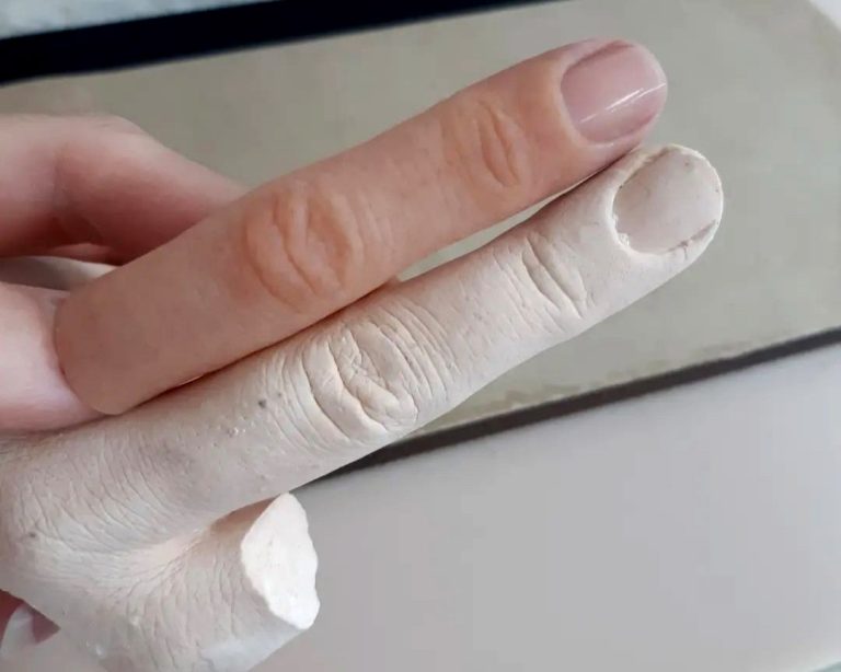 انگشت مکانیکی ثانی (8)